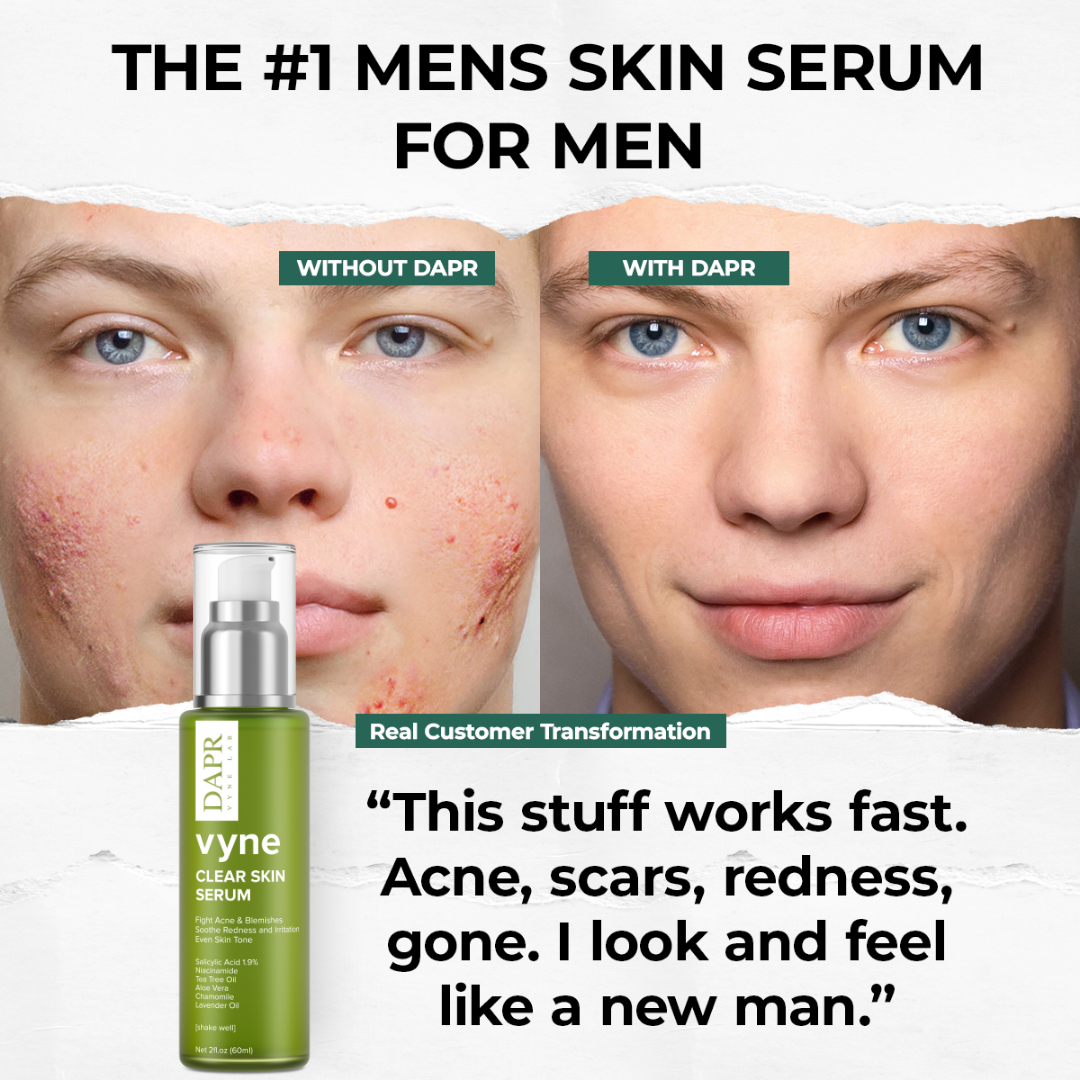 CLEAR SKIN SERUM