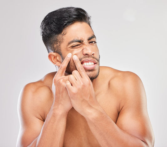 How to Prevent and Treat Back and Body Acne for Men